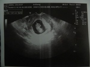 Baby "Little Bean" Zachariah as of June 26, 2013. I have vowed not to post ultrasound pics on Facebook, but that doesn't mean I won't do it on here.